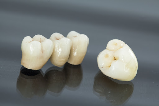Dental Crowns