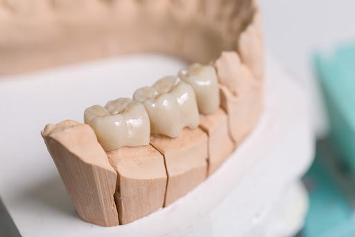 a row of teeth